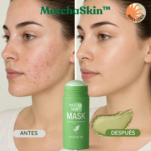 MatchaSkin™ - Purifica y refresca tu piel desde casa